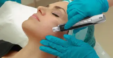 MICRONEEDLING