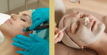 PEELING & MICRONEEDLING MESOESTETIC